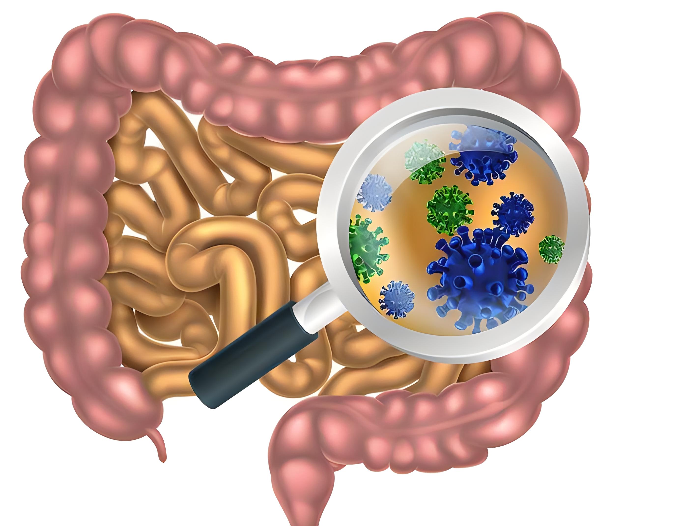 护肠道，别错过这个检查