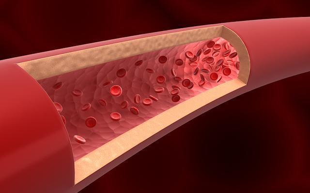 5招帮血管保持年轻